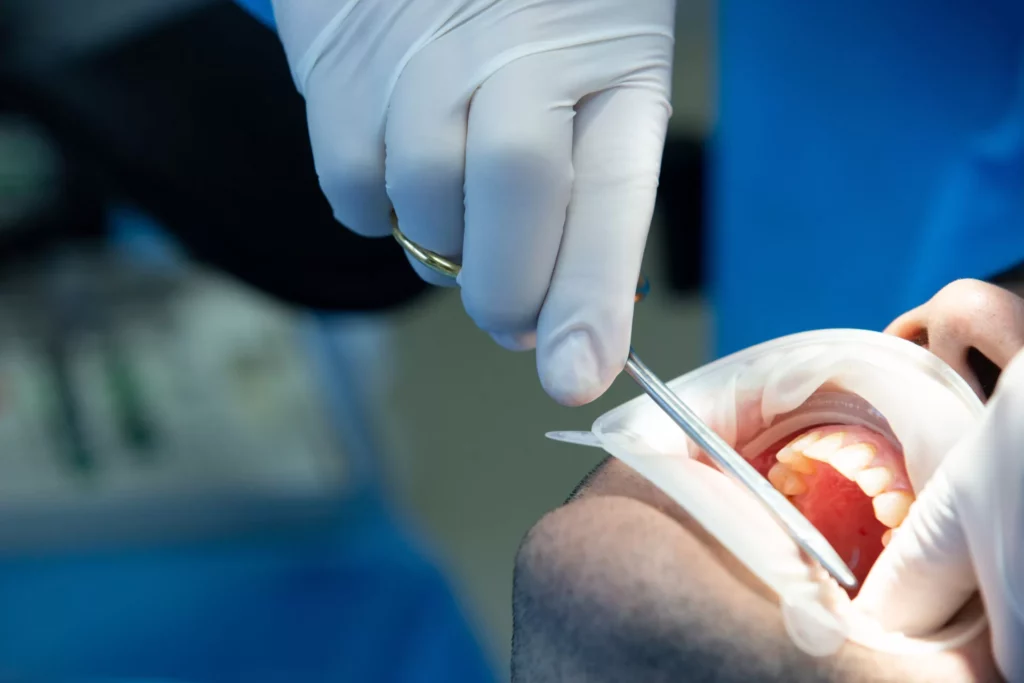 Dentures sealants