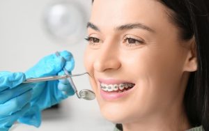 Orthodontic Treatment - Dental Braces