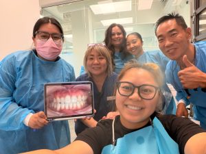 Veneers